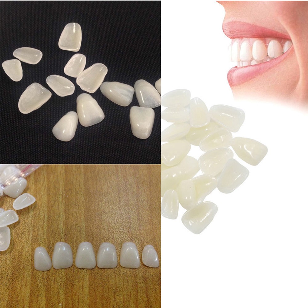 Teeth Whitening Mask - 70 Peças/Pacote de Facetas Dentárias Estéticas