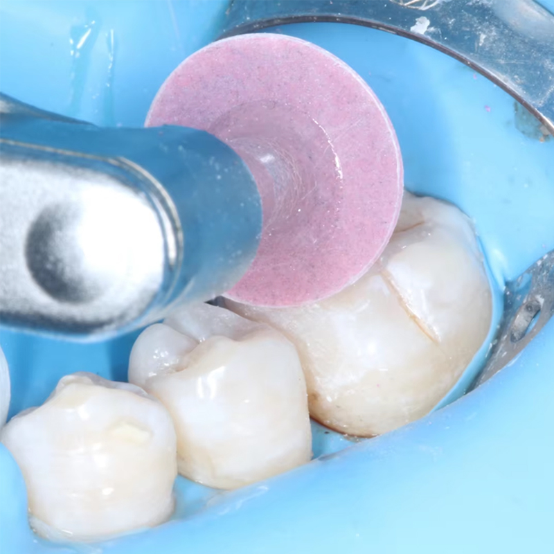40 Peças de Discos de Poliment - Whitening Teeth Dentist avaliação e preço