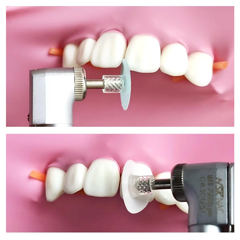 40 Peças de Discos de Poliment - Whitening Teeth Dentist avaliação e preço