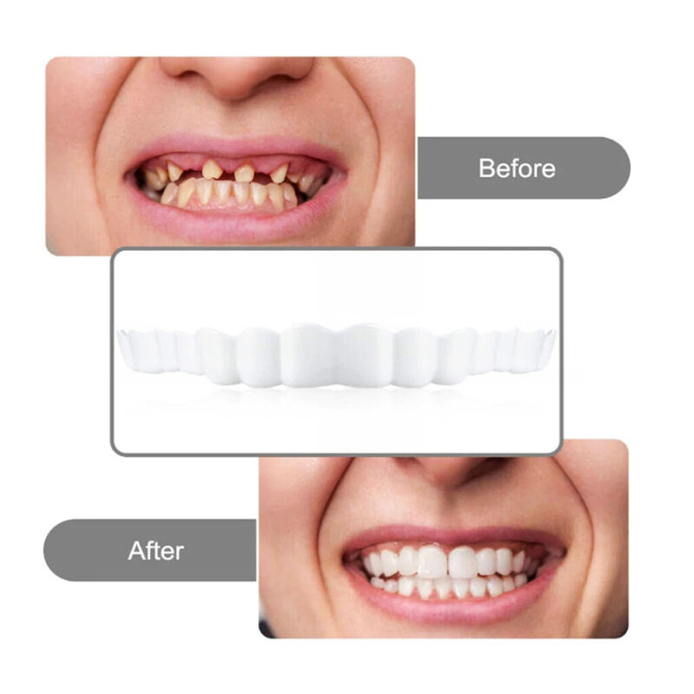 4-6 pares de dentaduras de man - Teeth Whitening Mask avaliação e preço