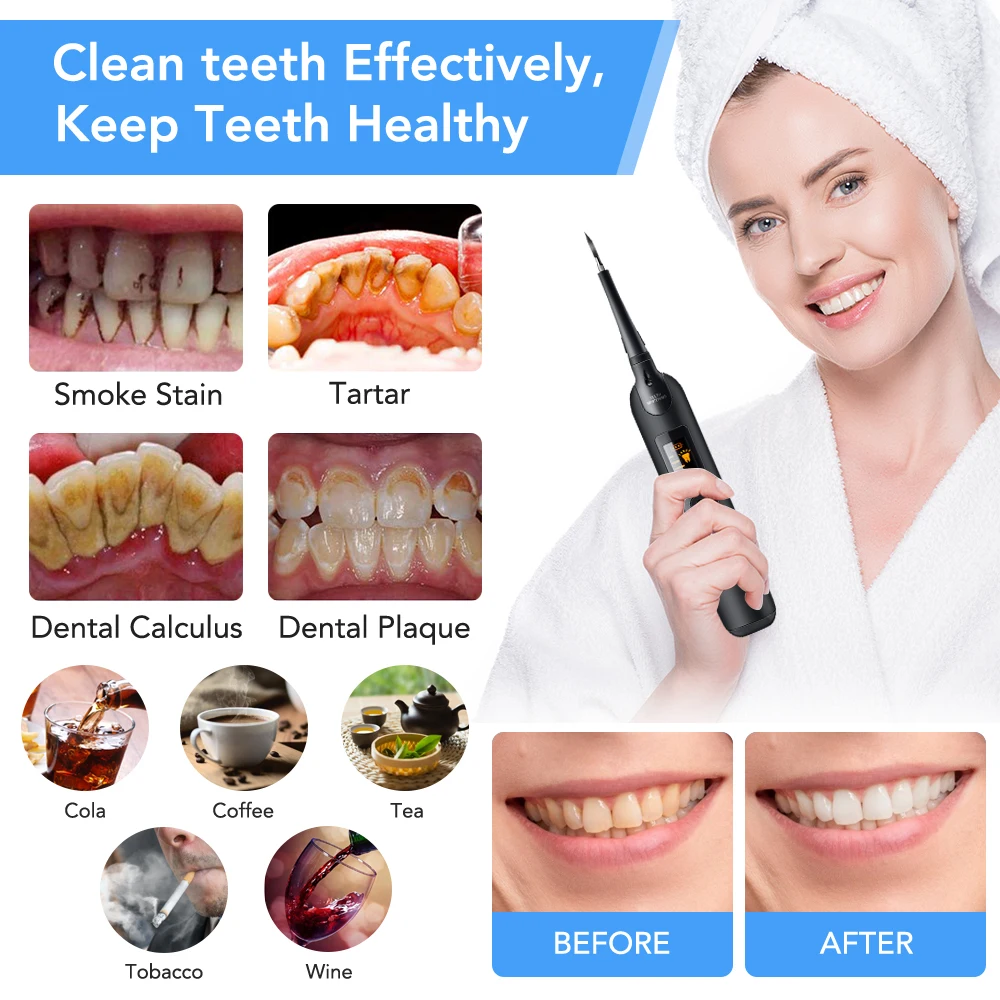 Conjunto de escova de dentes e - Teeth Whitening Free avaliação e preço