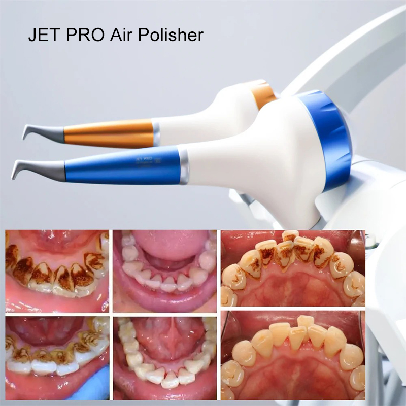 VV Dental Air Polishing Prophy - Teeth Whitening Free avaliação e preço