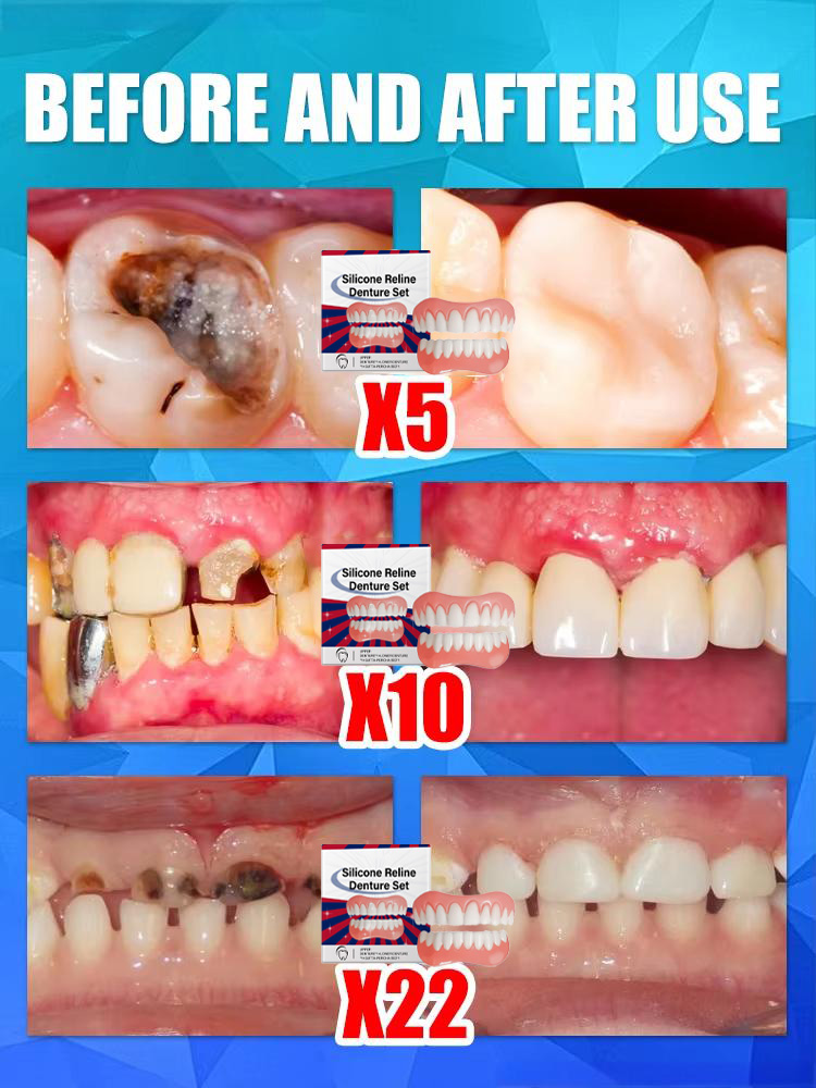 Dentes falsos silicone superio - Teeth Whitening Mask avaliação e preço
