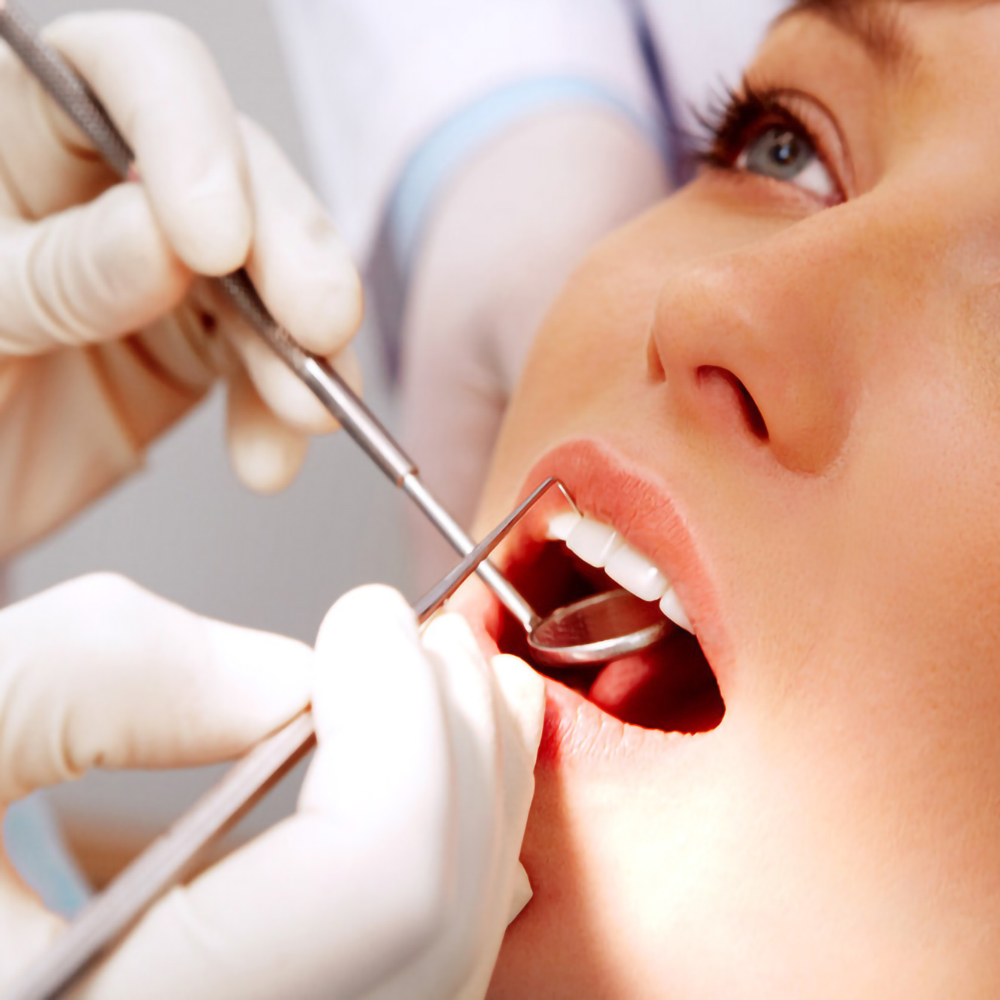 5 pçs de aço inoxidável dental - Teeth Whitening Products avaliação e preço