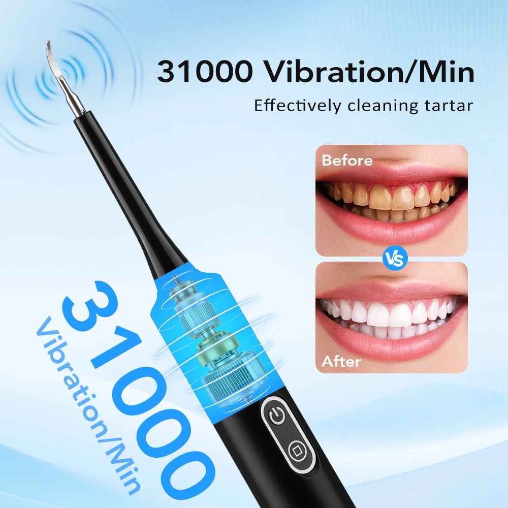 Escova de Dentes Elétrica com  - Teeth Whitening Products avaliação e preço
