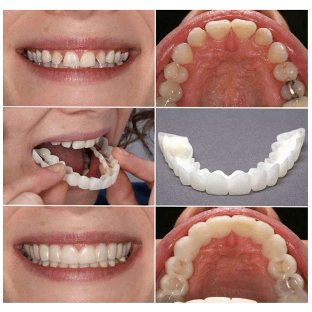 Dentadura clareadora de dentes - Teeth Whitening Mask avaliação e preço